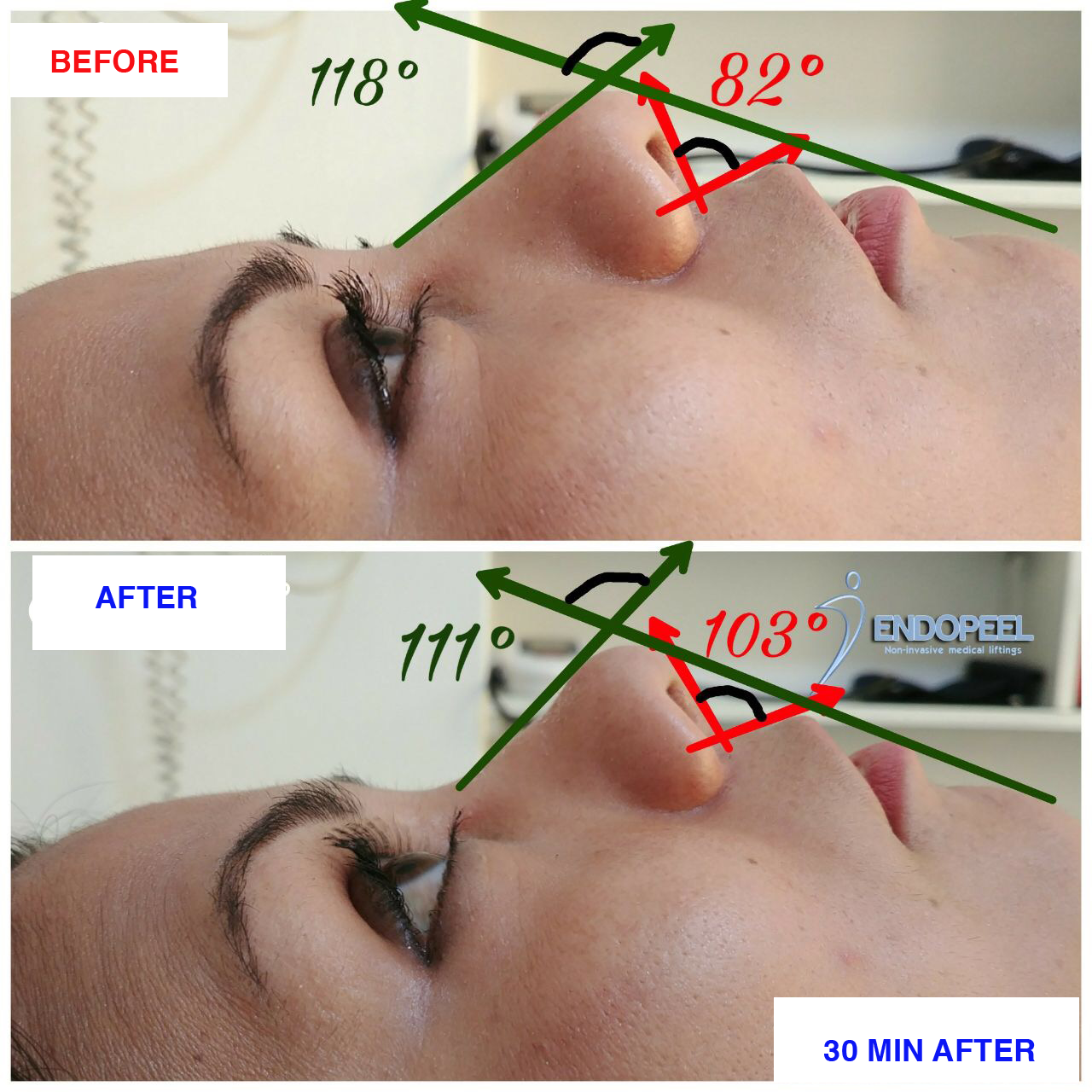Figure10