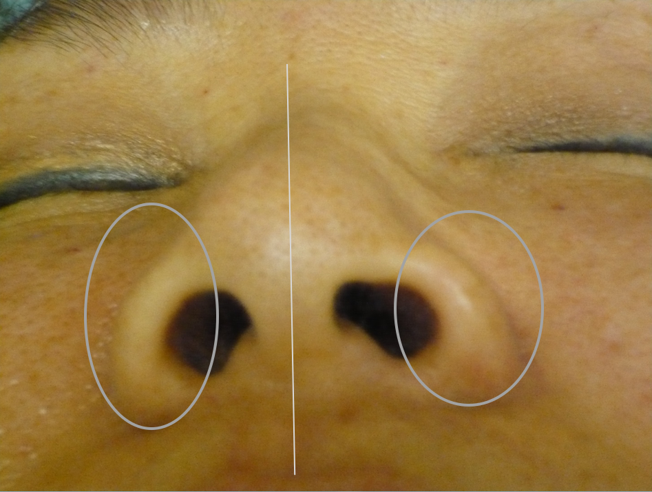 Figure3