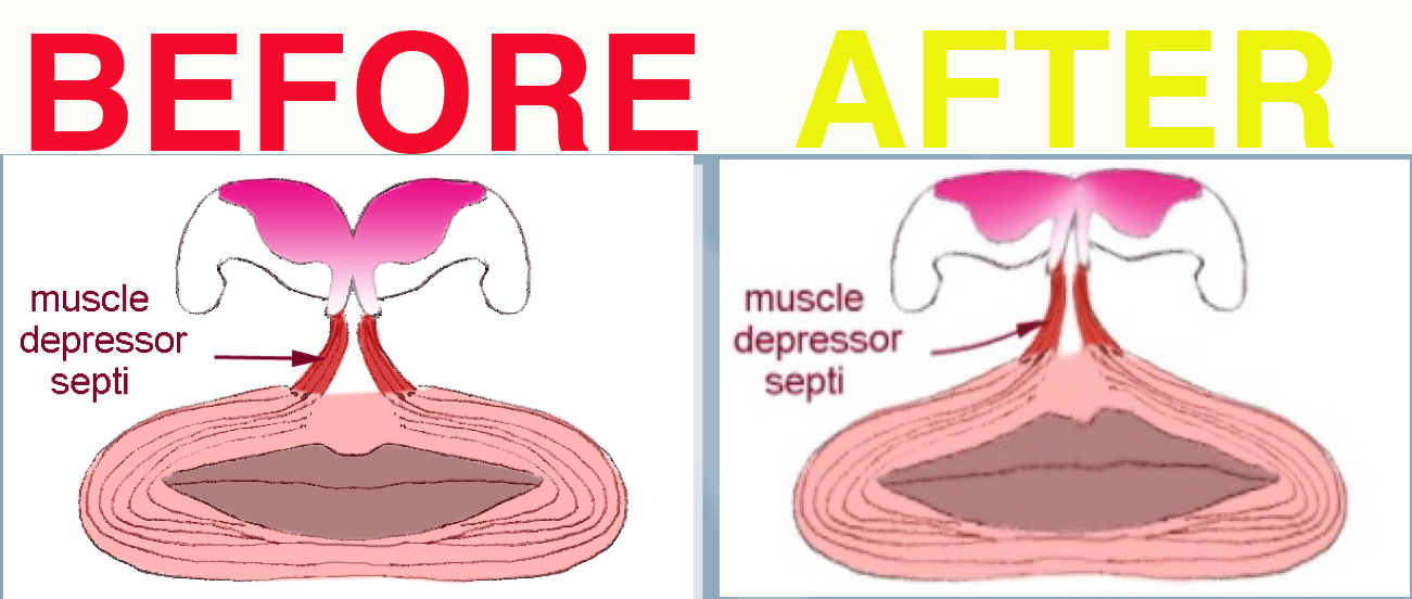 Figure8